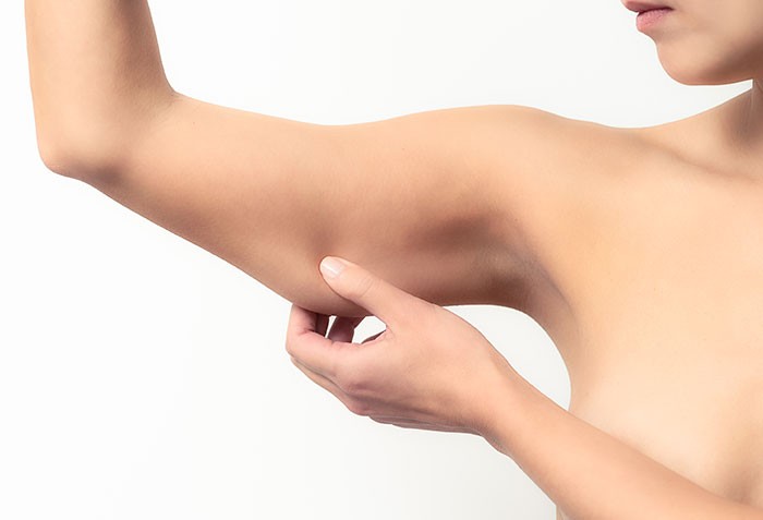 coolsculpting arms treatment