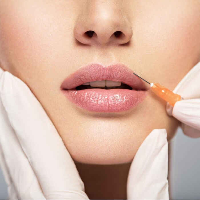 restylane injectable filler